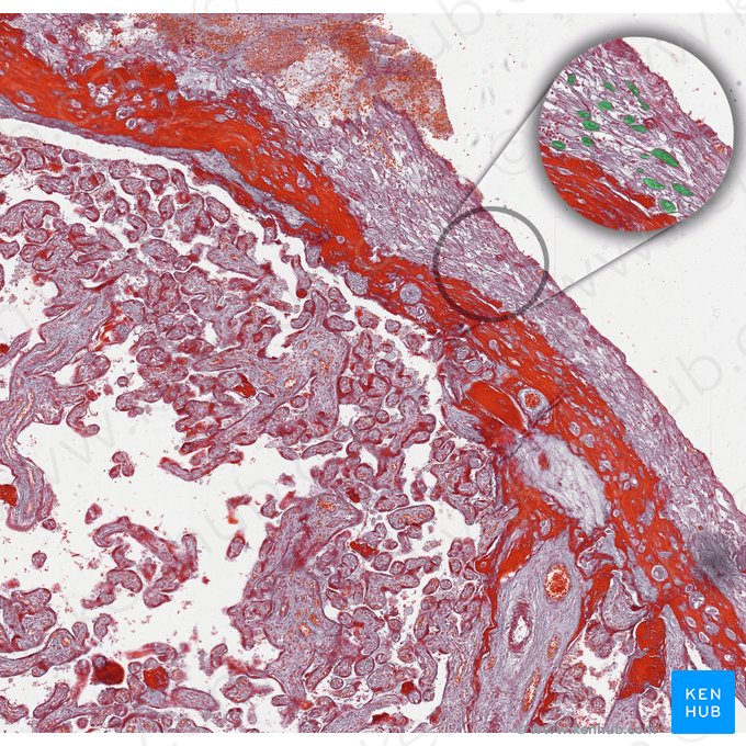 Decidual cells; Image: 