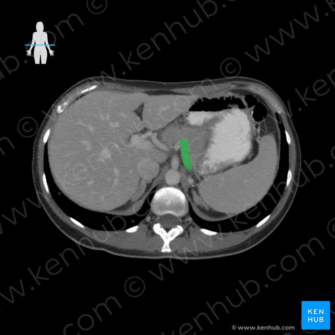 Splenic vein (Vena splenica); Image: 