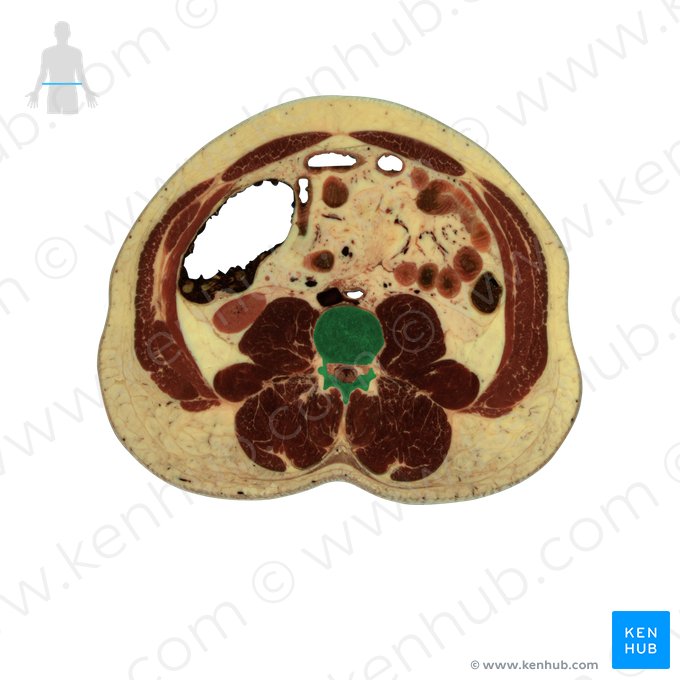 Vertebra L3 (Wirbel L3); Bild: National Library of Medicine