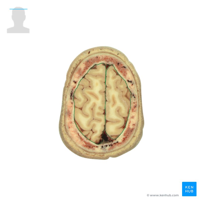 Arachnoid mater: Cross-sectional view