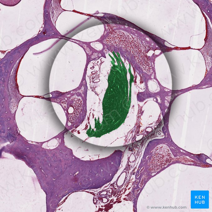 Nervio vestibulococlear (Nervus vestibulocochlearis); Imagen: 