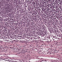 Reticular connective tissue