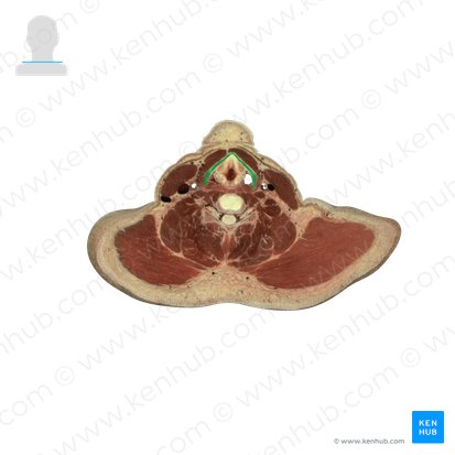Cartílago tiroides (Cartilago thyroidea); Imagen: National Library of Medicine