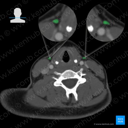 Anterior jugular vein (Vena jugularis anterior); Image: 