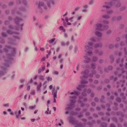 Mecanorreceptores periféricos