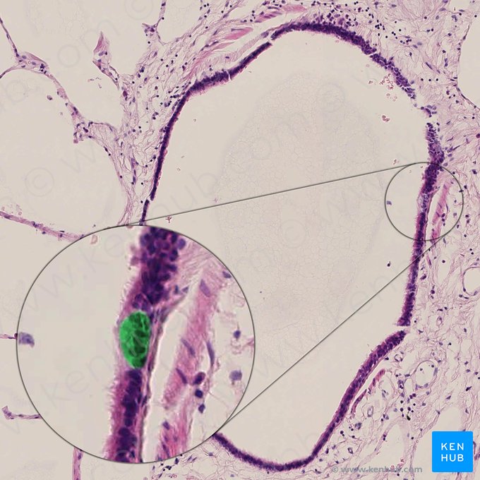 Células de Clara (Exocrinocytus bronchiolaris); Imagem: 