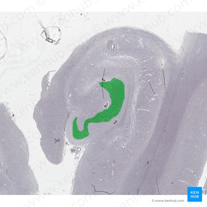 Gyrus dentatus (Zahnwindung); Bild: 