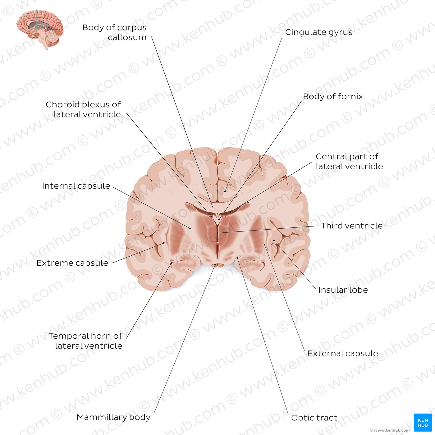 Coronal section of the brain (thalamus level): White matter structures