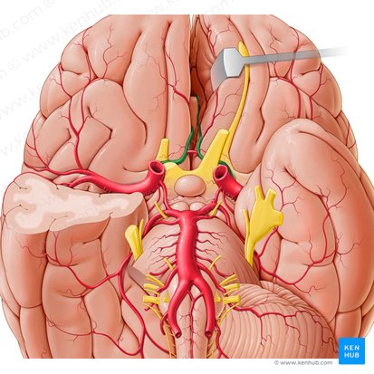 Artéria cerebral anterior (Arteria anterior cerebri); Imagem: Paul Kim
