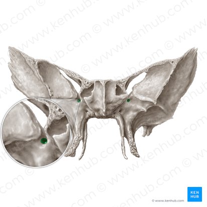 Foramen rotundum; Image: Samantha Zimmerman