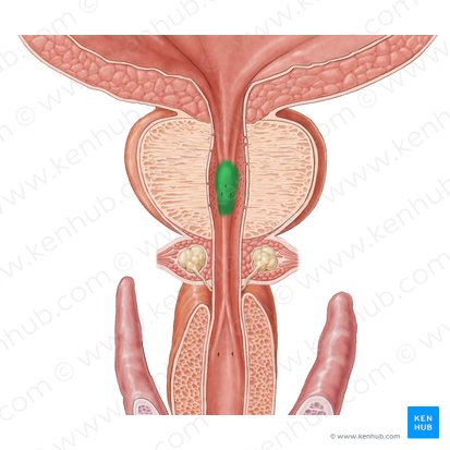 Collicule séminal (Colliculus seminalis); Image : Samantha Zimmerman