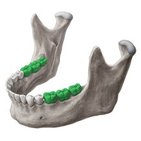 Molar tooth