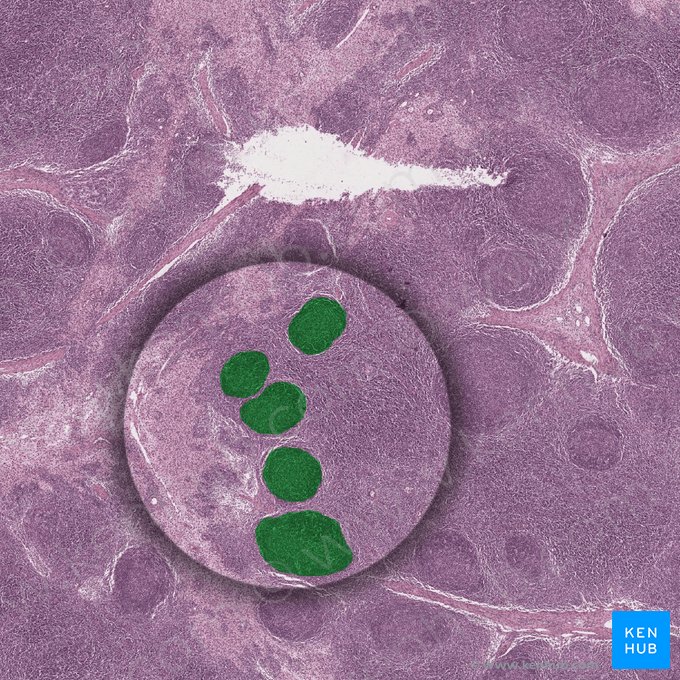 Lymphoid nodule (Nodulus lymphoideus); Image: 