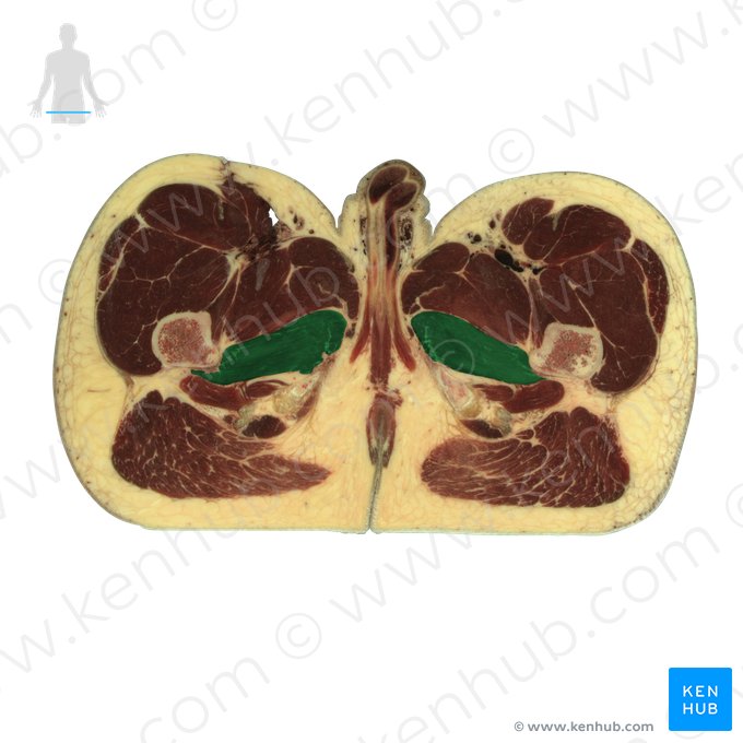 Músculo adutor magno (Musculus adductor magnus); Imagem: National Library of Medicine