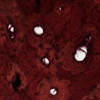 Bone tissue