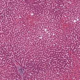 Liver