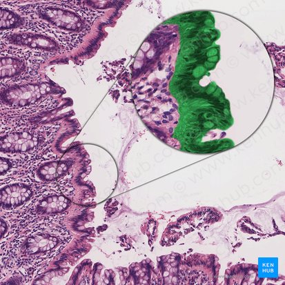 Épithélium cylindrique simple (avec bordure striée) (Epithelium simplex columnare microvillosum); Image : 