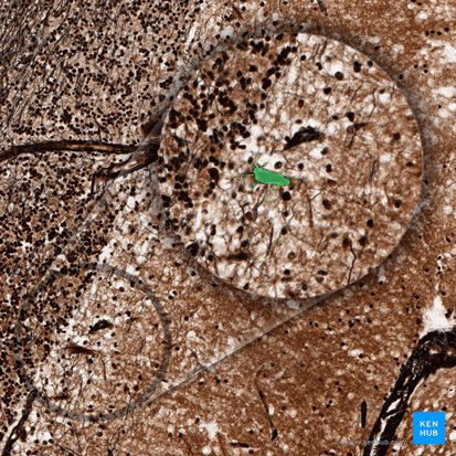 Astrocyte (Astrocytus); Image : 