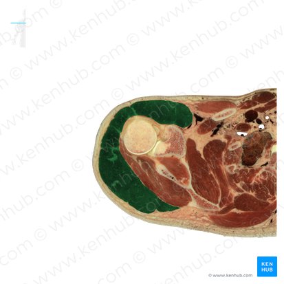 Músculo deltoides (Musculus deltoideus); Imagen: National Library of Medicine