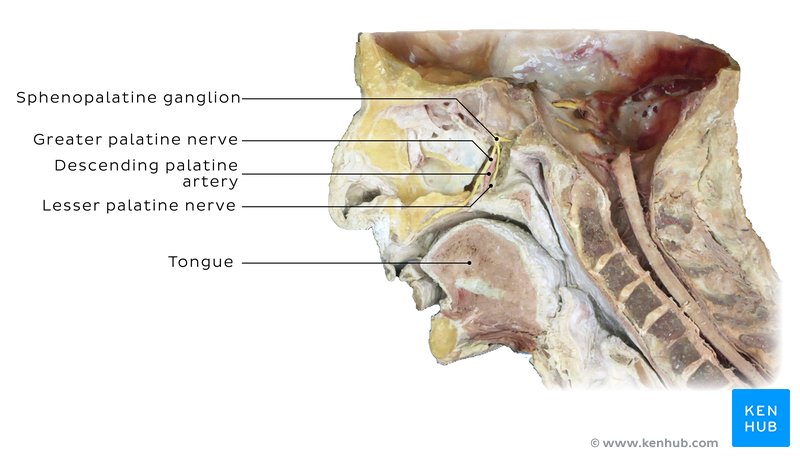 Pterygopalatine (sphenopalatine) ganglion in a cadaver