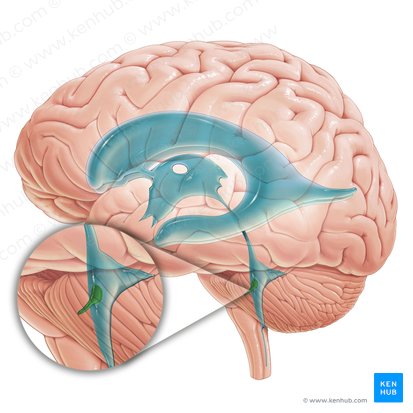 Recessus lateralis ventriculi quarti (Recessus lateralis des vierten Ventrikels); Bild: Paul Kim