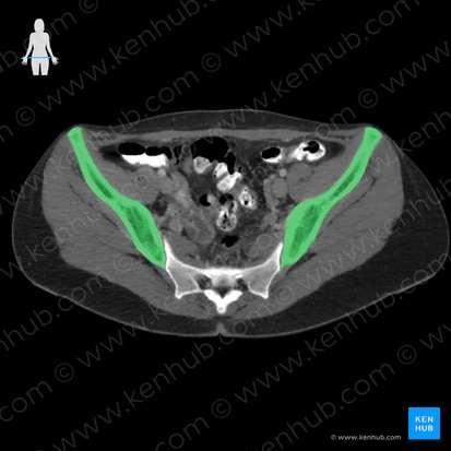 Os ilium (Darmbein); Bild: 
