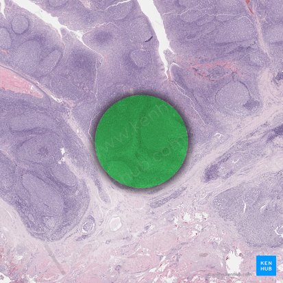 Tejido conectivo reticular; Imagen: 