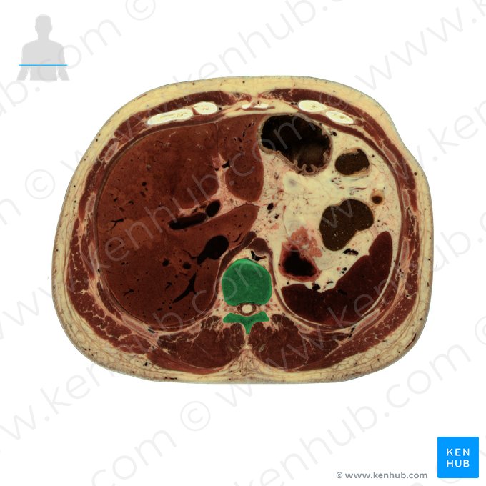 Vértebra T11 (Vertebra T11); Imagem: National Library of Medicine