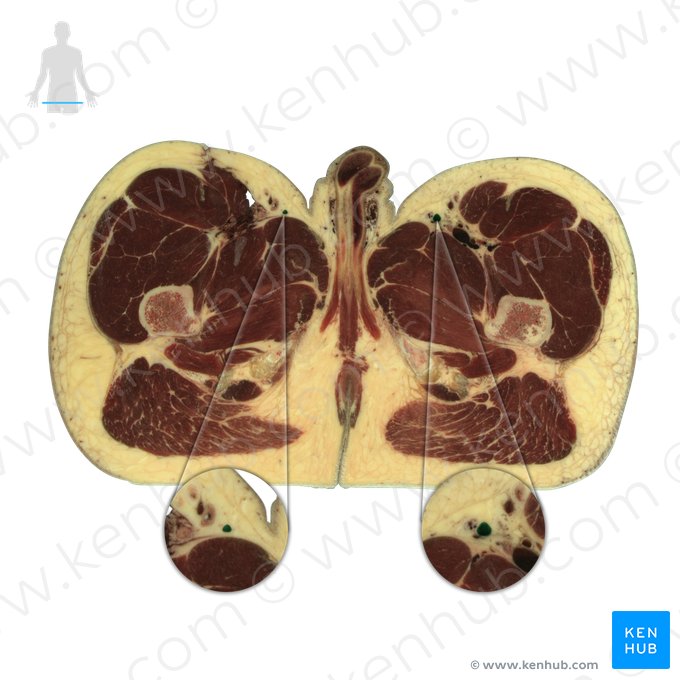 Veia safena magna (Vena saphena magna); Imagem: National Library of Medicine