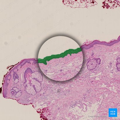 Epidermis (Oberhaut); Bild: 
