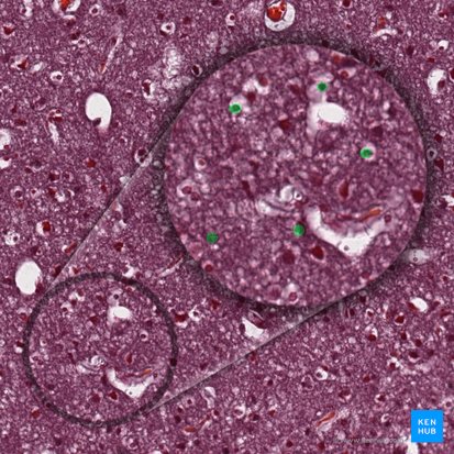Glial cells (Neuroglia); Image: 