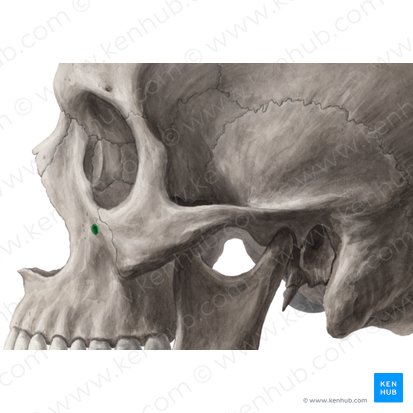 Foramen infraorbitale maxillae (Unteraugenhöhlenloch des Oberkieferknochens); Bild: Yousun Koh