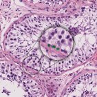 Spermatogenese