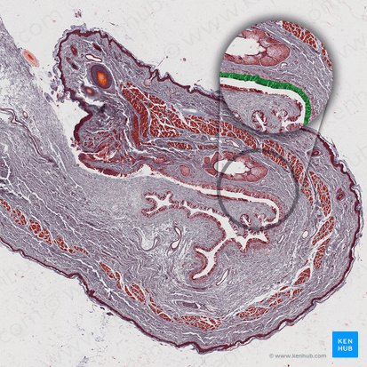 Conjuntiva palpebral (Tunica conjunctiva palpebrarum); Imagem: 