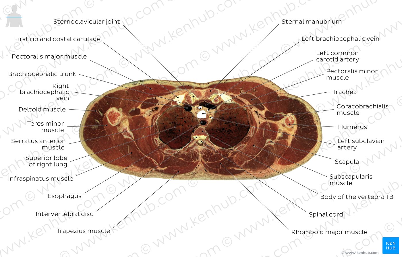 Cross section of the thorax through T3: Diagram