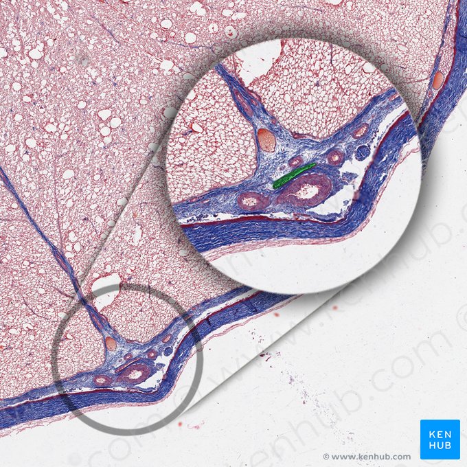 Vena espinal anterior (Vena spinalis anterior); Imagen: 