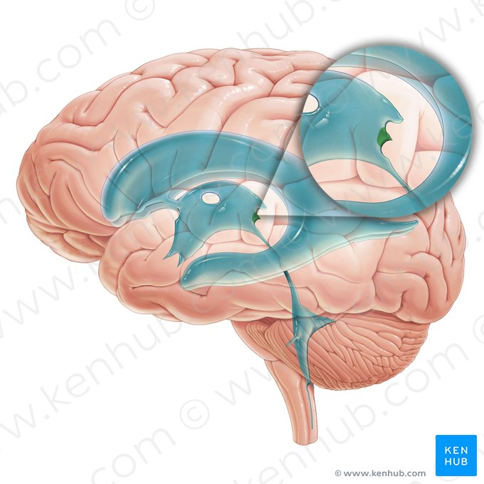 Receso de la glándula pineal (Recessus pinealis ventriculi tertii); Imagen: Paul Kim