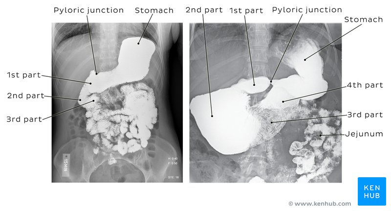 Gastrointestinal radiography - ventral view