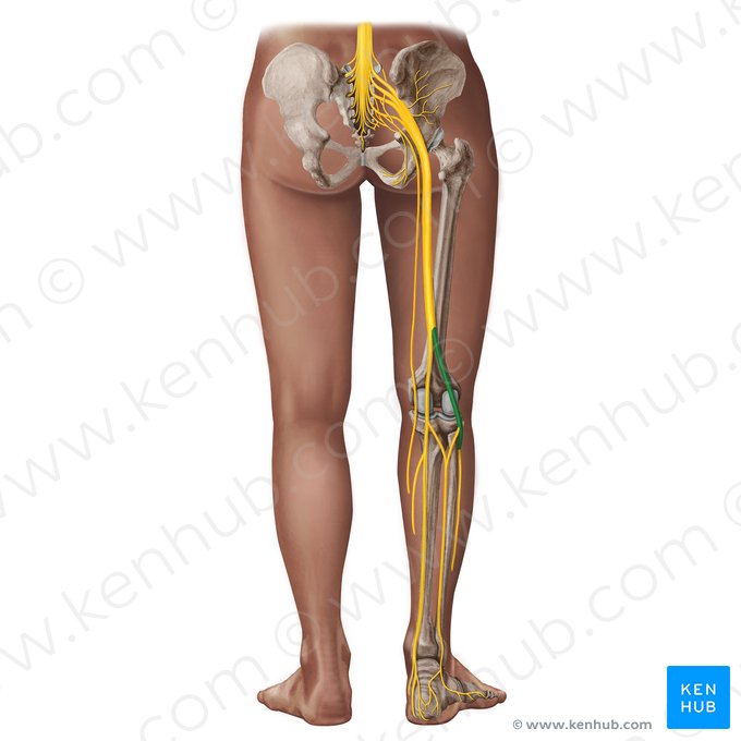 Nervio fibular común (Nervus fibularis communis); Imagen: Irina Münstermann