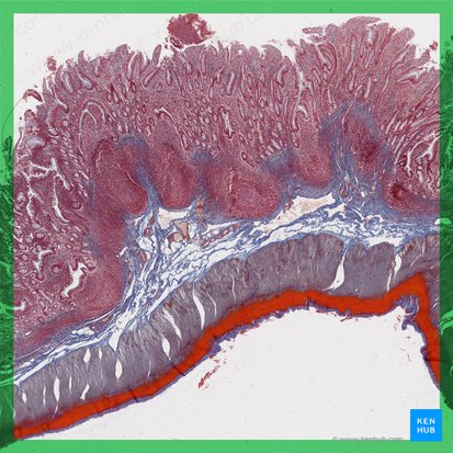 Íleon (Ileum); Imagen: 
