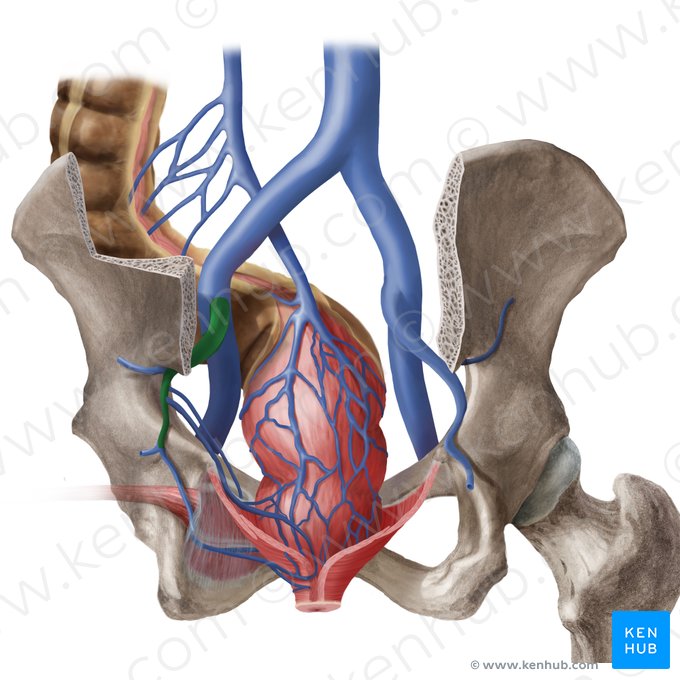 Left internal iliac vein (Vena iliaca interna sinistra); Image: Begoña Rodriguez