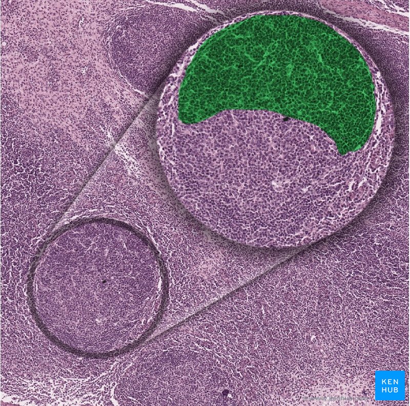 Centroblasts - histological slide