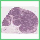 Histology of lymph nodes