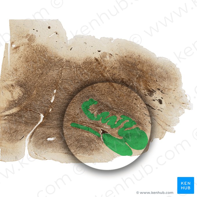 Complejo olivar inferior (Nucleus olivaris inferior principalis); Imagen: 