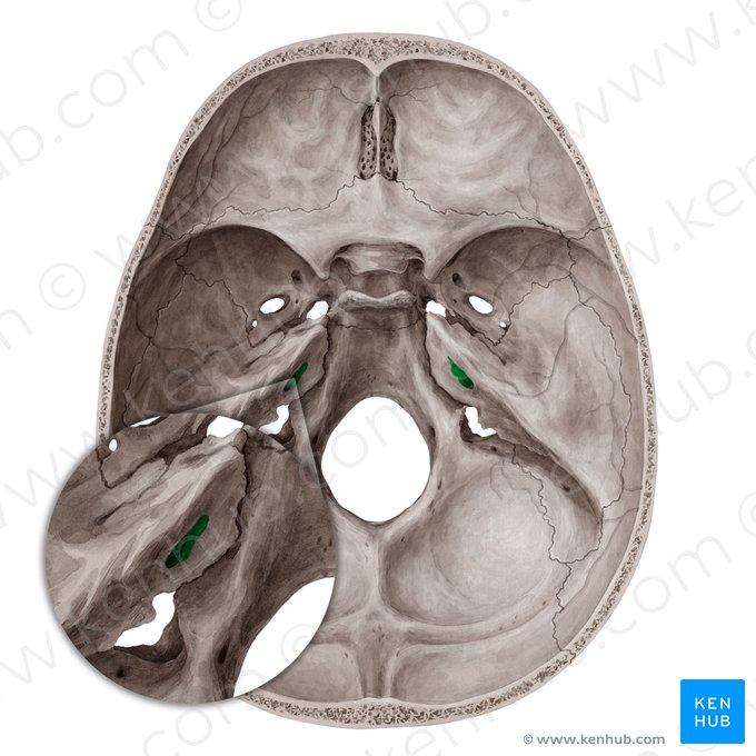 Meatus acusticus internus (Innerer Gehörgang); Bild: Yousun Koh