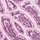 Simple epithelium