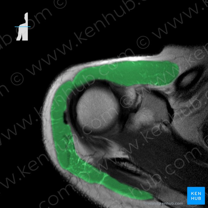 Deltoid muscle (Musculus deltoideus); Image: 