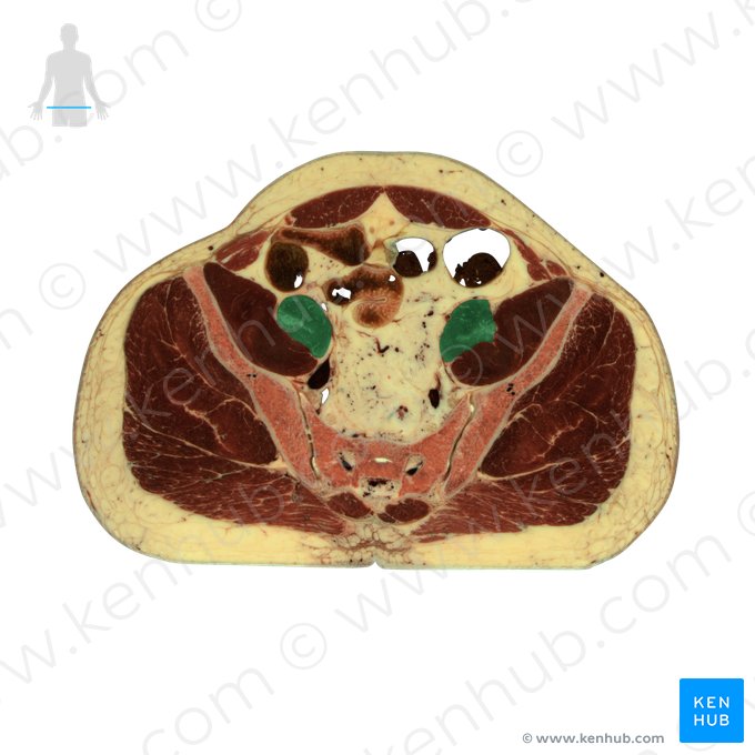 Psoas major muscle (Musculus psoas major); Image: National Library of Medicine