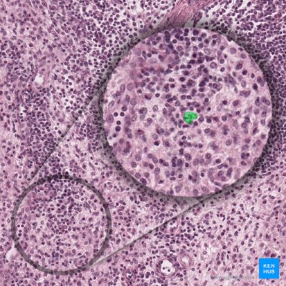 Macrophagocytus (Makrophage); Bild: 