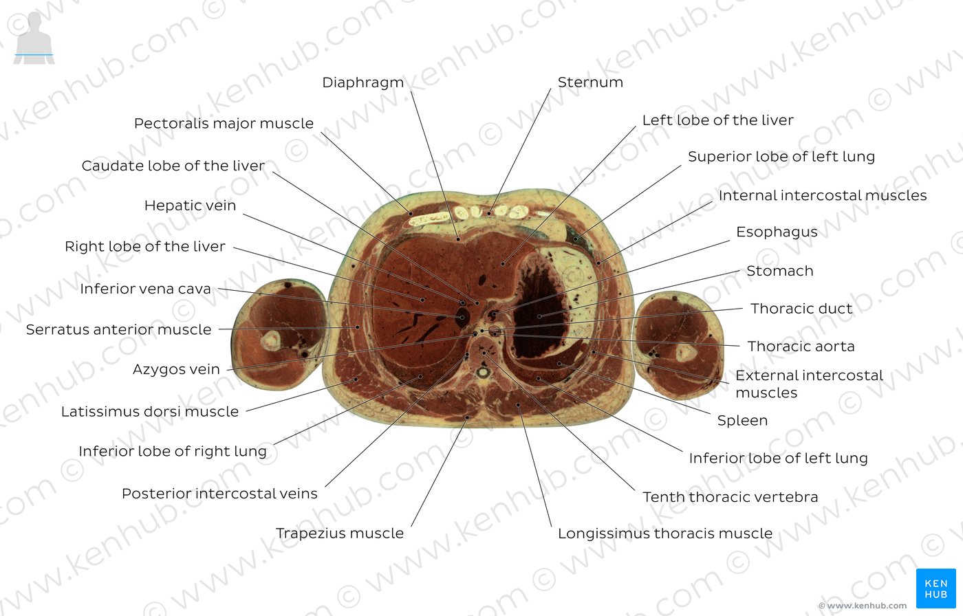 Tenth thoracic vertebra level: Overview